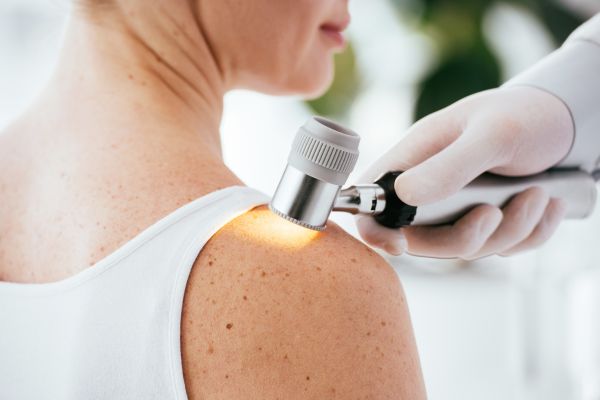 Dermatology