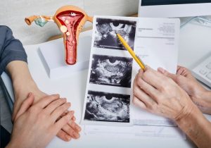 The Importance of Regular Gynecological Checkups
